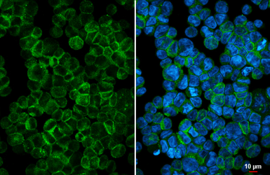 Anti-ICAM4 antibody [HL5612] used in Immunocytochemistry/ Immunofluorescence (ICC/IF). GTX646294